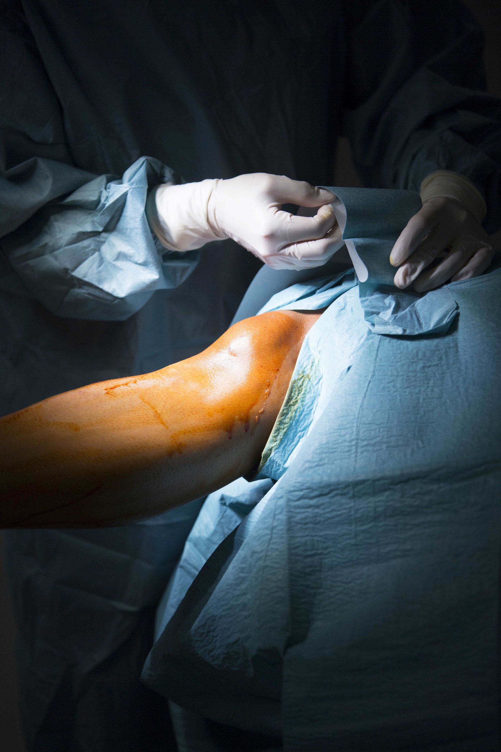 Vascular Surgery