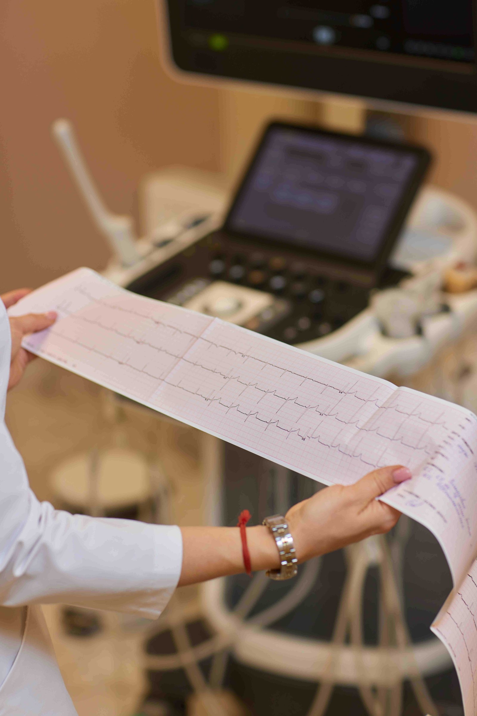 ECG